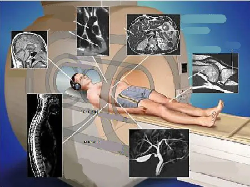 МРТ диагностика рака