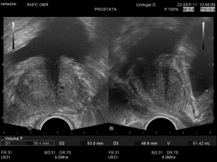 Ultrazukovaya Diagnostika