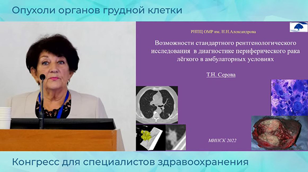 respublikanskaya nauchno prakticheskaya konferentsii s mezhdunarodnym uchastiem kardiotorakalnaya radiologiya 3